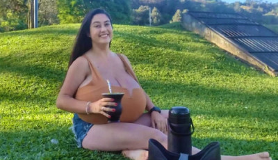 Havi 750 grammal nőttek a fiatal l&aacute;ny mellei &ndash; a boltban tolvajnak hitt&eacute;k, v&eacute;g&uuml;l m&aacute;r j&aacute;rni sem tudott